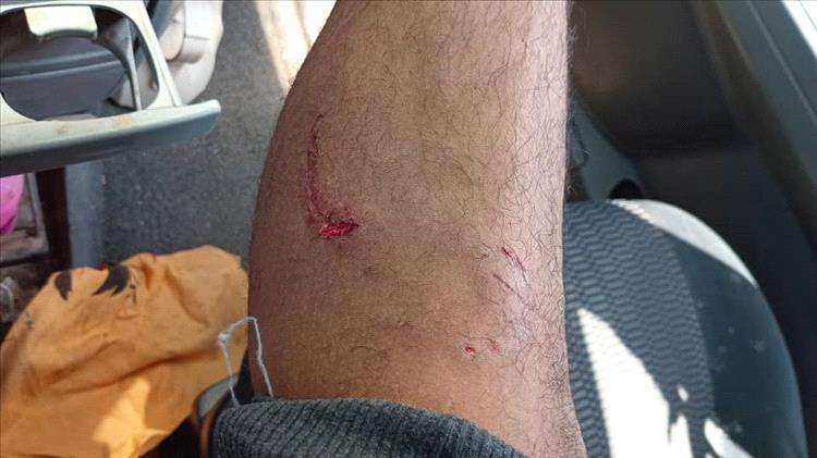 عدن.. كلب مسعور يهاجم مواطنا ويتمكن من عضه بالمنصورة وسط هلع الأهالي