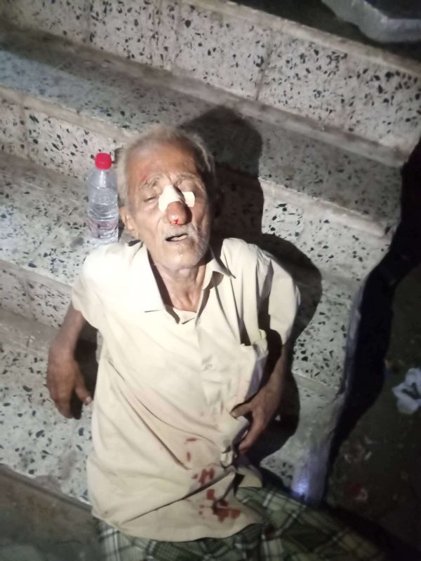 عدن.. مواطن يغمى عليه في الشارع نتيجة الحر وسط انقطاع شبه تام لخدمة الكهرباء