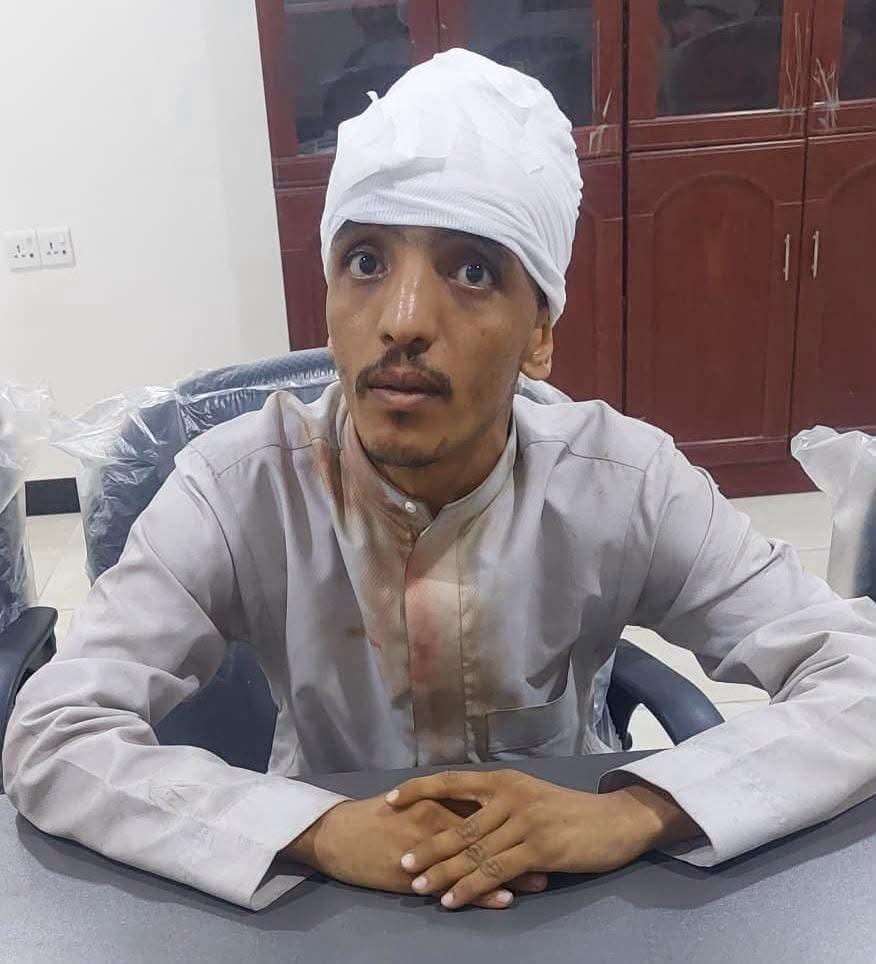 عدن.. عناصر الانتقالي المنحل تعتدي بالضرب على مصور بتهمة العمل مع قناة المهرية