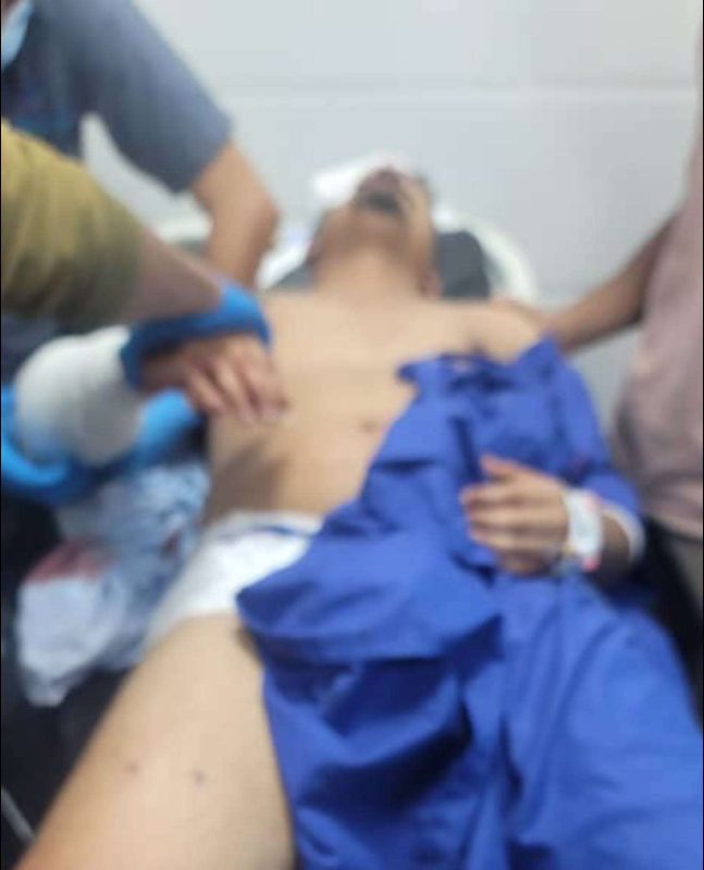 عدن.. مسلحون يطلقون النار على بائع سمك ويصيبونه بعدة طلقات وسط أحد مطاعم المدينة